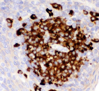 CD82 Rabbit Polyclonal Antibody