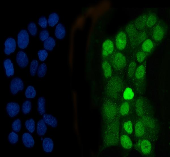 CEBP Beta/CEBPB Rabbit Polyclonal Antibody