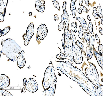 CEBP Beta/CEBPB Rabbit Polyclonal Antibody