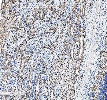 CEBP Beta/CEBPB Rabbit Polyclonal Antibody