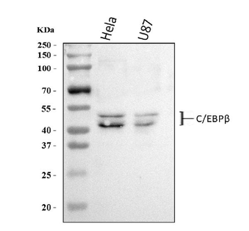 CEBP Beta/CEBPB Rabbit Polyclonal Antibody