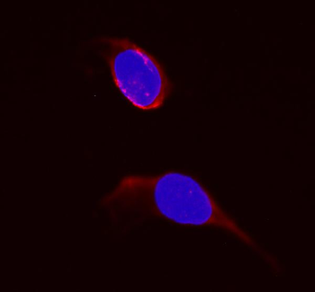 Dihydrofolate reductase Rabbit Polyclonal Antibody