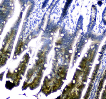 Dihydrofolate reductase Rabbit Polyclonal Antibody