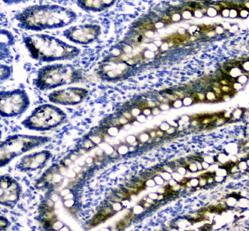 Dihydrofolate reductase Rabbit Polyclonal Antibody