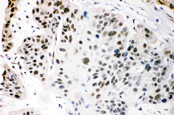 KAT3B/p300/EP300 Rabbit Polyclonal Antibody