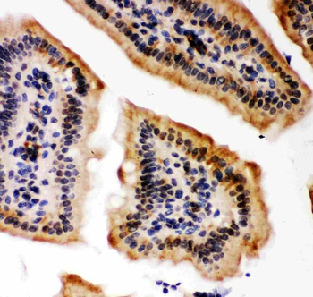 KAT3B/p300/EP300 Rabbit Polyclonal Antibody