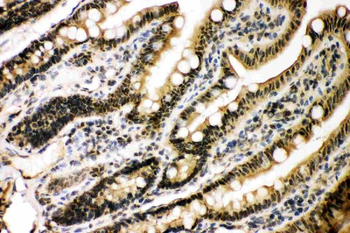 KAT3B/p300/EP300 Rabbit Polyclonal Antibody
