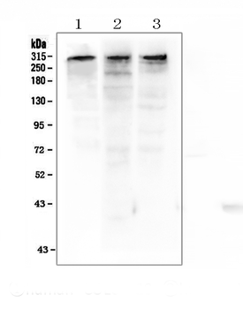 KAT3B/p300/EP300 Rabbit Polyclonal Antibody