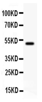 KAT3B/p300/EP300 Rabbit Polyclonal Antibody