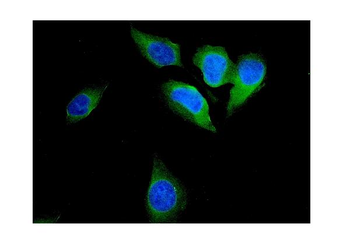 FHIT Rabbit Polyclonal Antibody