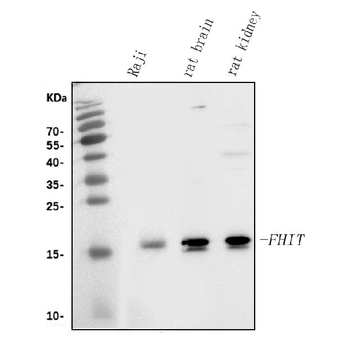 FHIT Rabbit Polyclonal Antibody