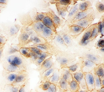 gamma Catenin/JUP Rabbit Polyclonal Antibody