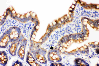 gamma Catenin/JUP Rabbit Polyclonal Antibody