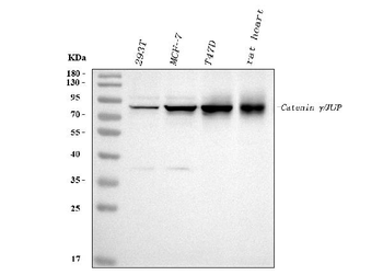 gamma Catenin/JUP Rabbit Polyclonal Antibody