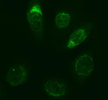 Caspase-3/CASP3 Rabbit Polyclonal Antibody