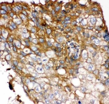 FGFR4 Rabbit Polyclonal Antibody