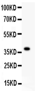 FGFR4 Rabbit Polyclonal Antibody