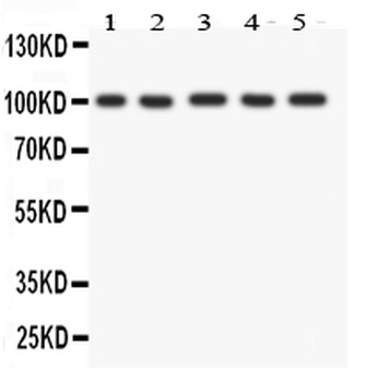 FGFR4 Rabbit Polyclonal Antibody