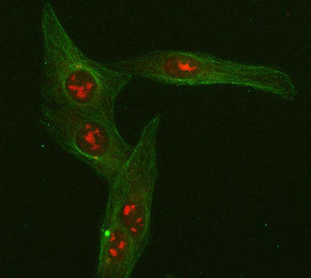 FOXO3A Rabbit Polyclonal Antibody