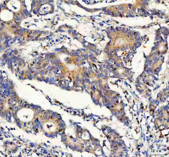 FOXO3A Rabbit Polyclonal Antibody