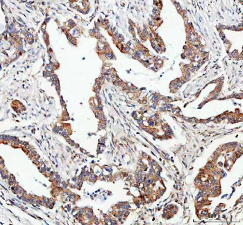 FOXO3A Rabbit Polyclonal Antibody