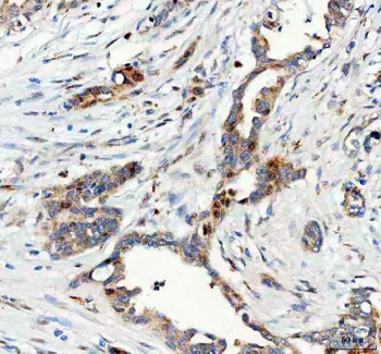 FOXO3A Rabbit Polyclonal Antibody