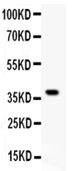 GATA3 Rabbit Polyclonal Antibody