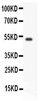 GDNF Receptor alpha 1/GFRA1 Rabbit Polyclonal Antibody
