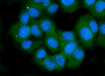 Ionotropic Glutamate receptor 2/GRIA2 Rabbit Polyclonal Antibody