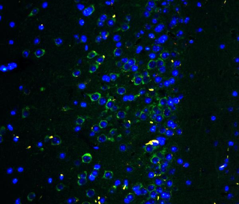 Ionotropic Glutamate receptor 2/GRIA2 Rabbit Polyclonal Antibody