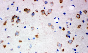 Ionotropic Glutamate receptor 2/GRIA2 Rabbit Polyclonal Antibody