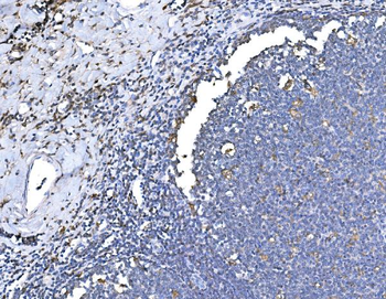 Heme Oxygenase 1/HMOX1 Rabbit Polyclonal Antibody