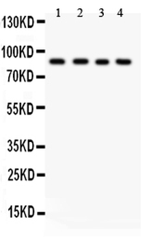 IKK beta/IKBKB Rabbit Polyclonal Antibody