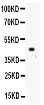 IKK beta/IKBKB Rabbit Polyclonal Antibody