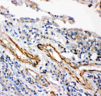 IKK beta/IKBKB Rabbit Polyclonal Antibody