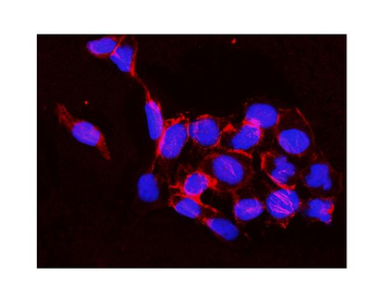 IKK beta/IKBKB Rabbit Polyclonal Antibody