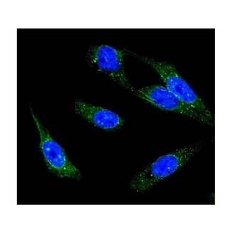 IP3 receptor/ITPR1 Rabbit Polyclonal Antibody