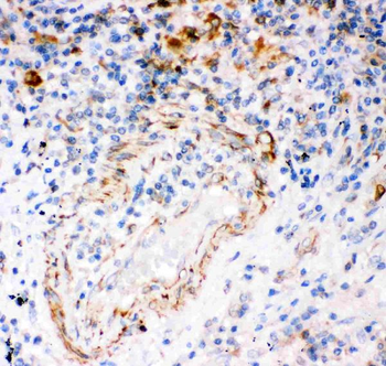 IP3 receptor/ITPR1 Rabbit Polyclonal Antibody