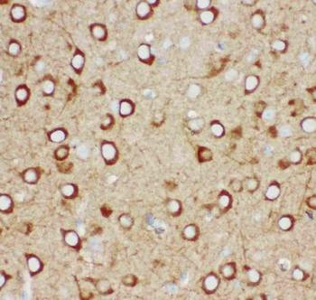 IP3 receptor/ITPR1 Rabbit Polyclonal Antibody