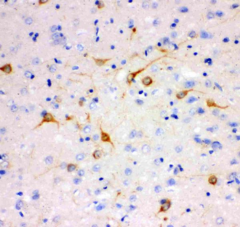 IP3 receptor/ITPR1 Rabbit Polyclonal Antibody