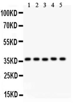KLF6 Rabbit Polyclonal Antibody