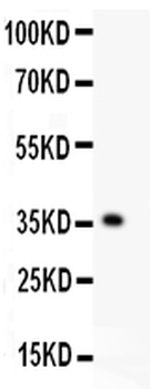 KLF6 Rabbit Polyclonal Antibody
