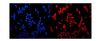 Glucocorticoid Receptor/NR3C1 Rabbit Polyclonal Antibody
