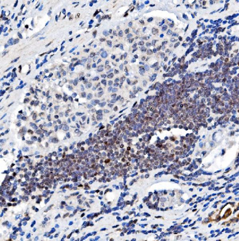 Glucocorticoid Receptor/NR3C1 Rabbit Polyclonal Antibody