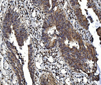 Glucocorticoid Receptor/NR3C1 Rabbit Polyclonal Antibody
