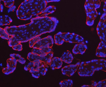 Transferrin Receptor/TFRC Rabbit Polyclonal Antibody