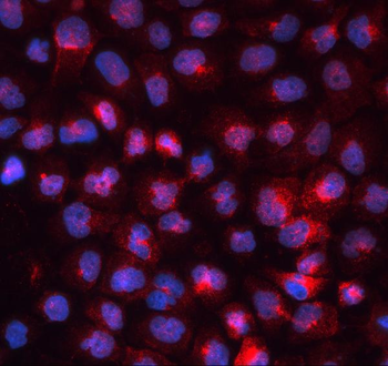 Transferrin Receptor/TFRC Rabbit Polyclonal Antibody