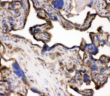 Transferrin Receptor/TFRC Rabbit Polyclonal Antibody