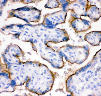Transferrin Receptor/TFRC Rabbit Polyclonal Antibody
