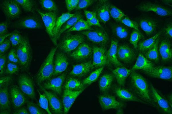 Hsp27/HSPB1 Rabbit Polyclonal Antibody